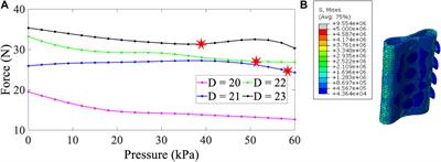 Numerical simulation of the effect of geometric parameters on silicone airway stent migration